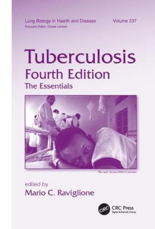 Buch Tuberculosis 