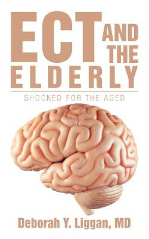 Knjiga Ect and the Elderly Md Deborah Y. Liggan