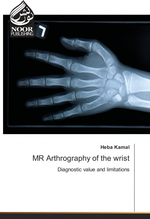 Książka MR Arthrography of the wrist Heba Kamal