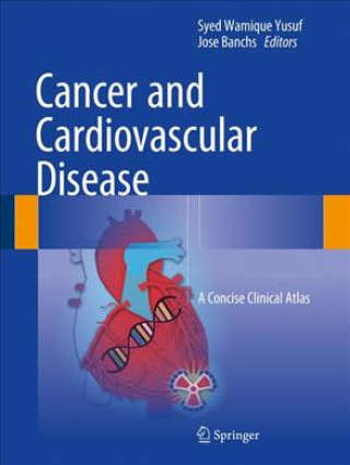 Книга Cancer and Cardiovascular Disease Syed Wamique Yusuf