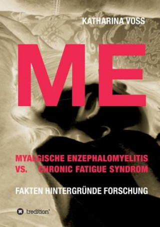 Könyv ME - Myalgische Enzephalomyelitis vs. Chronic Fatigue Syndrom Katharina Voss
