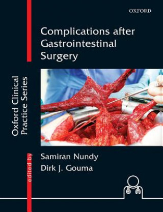 Buch Complications after Gastrointestinal Surgery Samiran Nundy