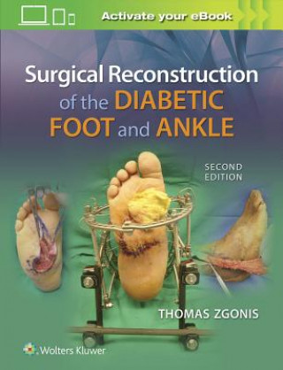 Książka Surgical Reconstruction of the Diabetic Foot and Ankle Thomas Zgonis