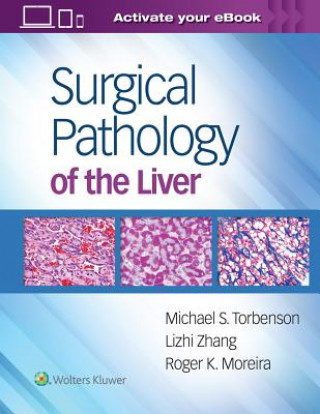 Kniha Surgical Pathology of the Liver Michael Torbenson