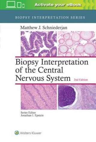 Kniha Biopsy Interpretation of the Central Nervous System Matthew J. Schniederjan