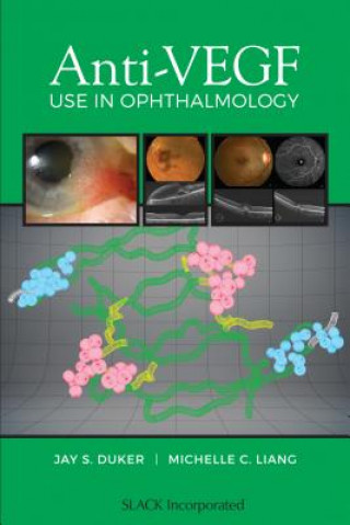 Kniha Anti-VEGF Use in Ophthalmology Jay S. Duker