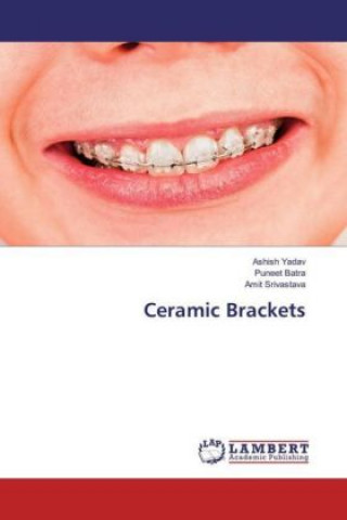 Knjiga Ceramic Brackets Ashish Yadav