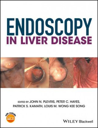 Libro Endoscopy in Liver Disease John N. Plevris