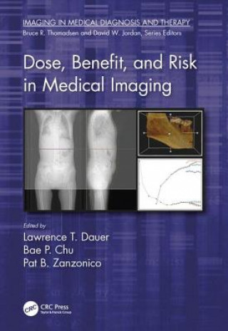 Książka Dose, Benefit, and Risk in Medical Imaging 