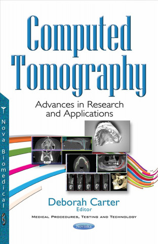 Книга Computed Tomography 
