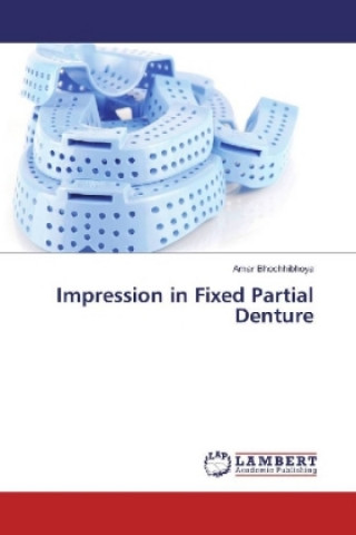 Книга Impression in Fixed Partial Denture Amar Bhochhibhoya