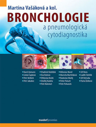 Könyv Bronchologie Martina Vašáková