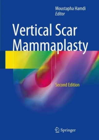 Könyv Vertical Scar Mammaplasty Moustapha Hamdi