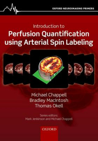 Könyv Introduction to Perfusion Quantification using Arterial Spin Labelling Michael Chappell