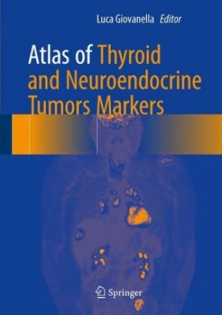 Książka Atlas of Thyroid and Neuroendocrine Tumor Markers Luca Giovanella