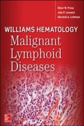 Kniha Williams Hematology Malignant Lymphoid Diseases John P. Leonard