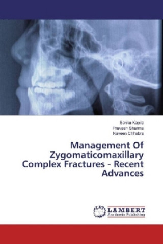 Książka Management Of Zygomaticomaxillary Complex Fractures - Recent Advances Sarika Kapila