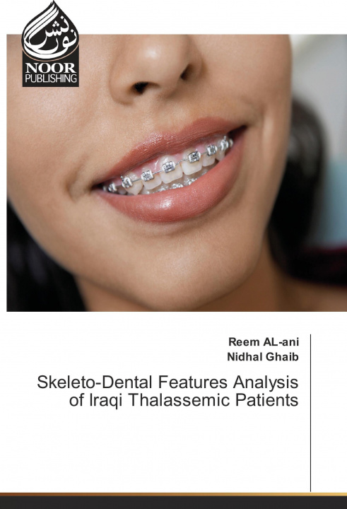 Buch Skeleto-Dental Features Analysis of Iraqi Thalassemic Patients Reem AL-ani