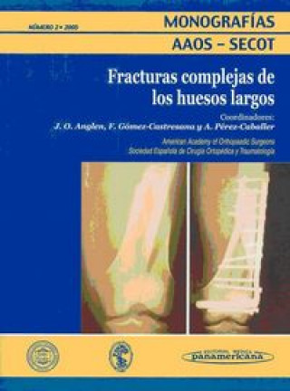 Kniha Fracturas complejas de los huesos largos 