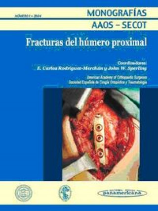 Kniha Fracturas del húmero proximal 
