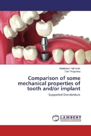 Carte Comparison of some mechanical properties of tooth and/or implant Abdalbasit Fatihallah