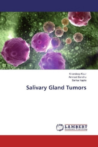 Kniha Salivary Gland Tumors Kirandeep Kaur