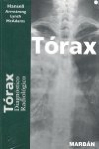 Carte Tórax : diagnóstico radiológico David . . . [et al. ] Hansell