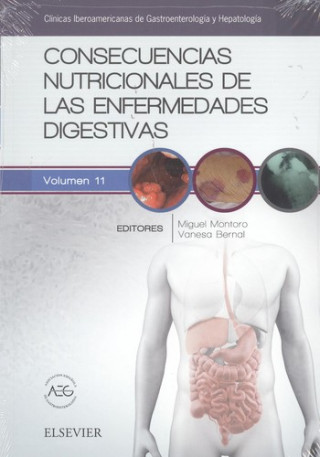 Könyv Consecuencias nutricionales de las enfermedades digestivas 