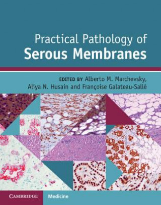 Könyv Practical Pathology of Serous Membranes EDITED BY ALBERTO MA