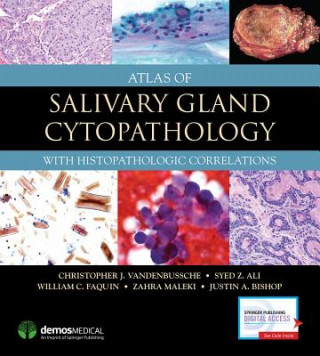 Kniha Atlas of Salivary Gland Cytopathology Christopher J. Vandenbussche