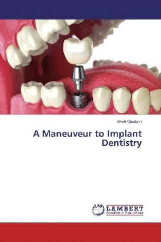 Knjiga A Maneuveur to Implant Dentistry Vivek Gautam