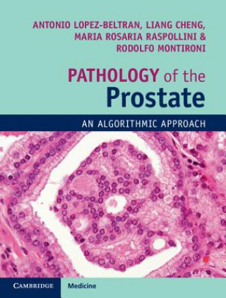 Książka Pathology of the Prostate LOPEZ BELTRA  ANTONI