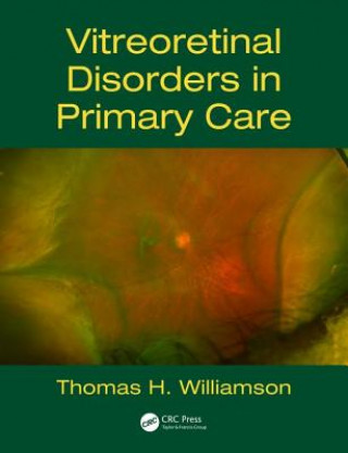 Kniha Vitreoretinal Disorders in Primary Care WILLIAMSON