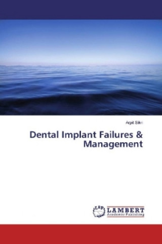 Kniha Dental Implant Failures & Management Arpit Sikri