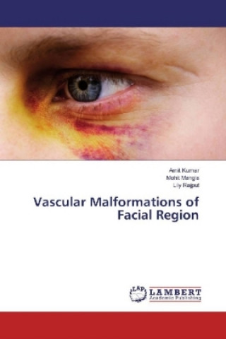 Kniha Vascular Malformations of Facial Region Amit Kumar