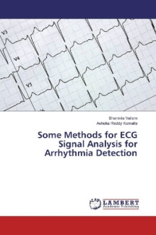 Kniha Some Methods for ECG Signal Analysis for Arrhythmia Detection Sharmila Vallem