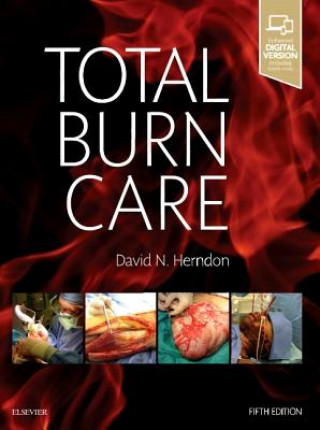 Könyv Total Burn Care Herndon