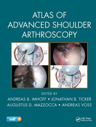 Kniha Atlas of Advanced Shoulder Arthroscopy 