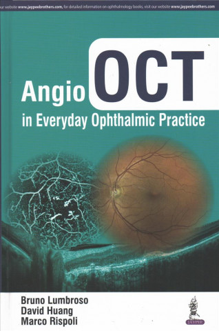 Kniha Angio OCT in Everyday Ophthalmic Practice Bruno Lumbroso