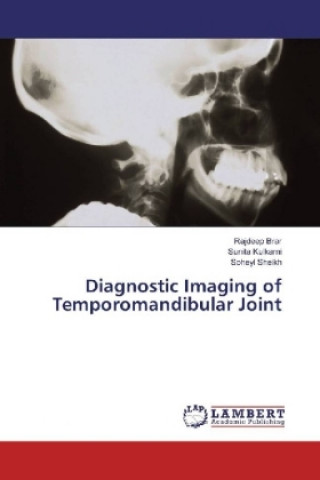 Knjiga Diagnostic Imaging of Temporomandibular Joint Rajdeep Brar