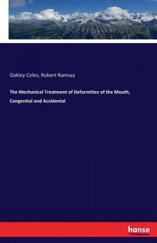 Book Mechanical Treatment of Deformities of the Mouth, Congenital and Accidental Oakley Coles