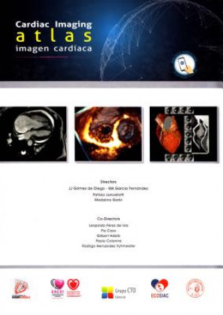 Kniha Atlas de Imagen Cardíaca-Cardiac Imaging Atlas Ma Garcia Fernandez