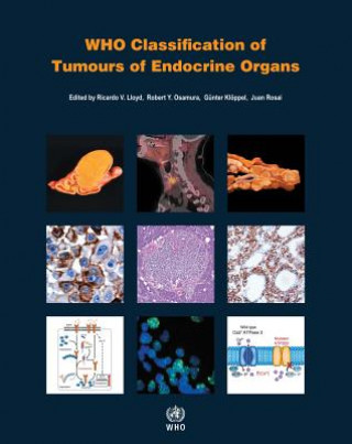 Carte Who Classification of Tumours of Endocrine Organs International Agency for Research on Can