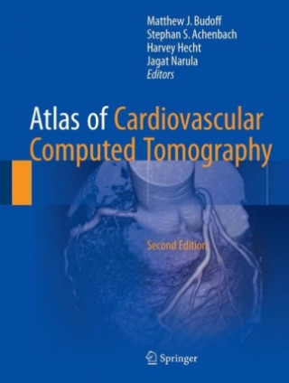 Knjiga Atlas of Cardiovascular Computed Tomography Matthew J. Budoff