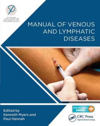 Könyv Manual of Venous and Lymphatic Diseases 