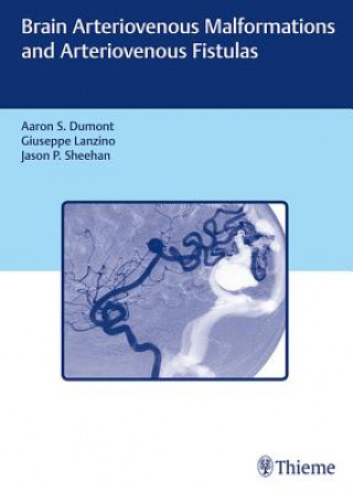 Libro Brain Arteriovenous Malformations and Arteriovenous Fistulas Aaron S. Dumont