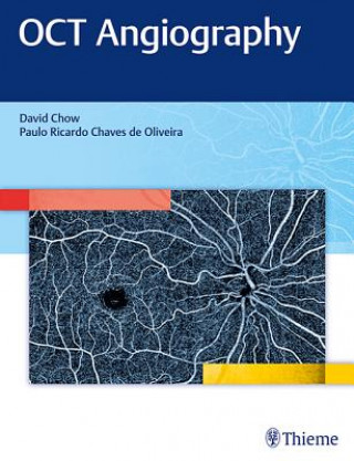 Kniha OCT Angiography David R. Chow