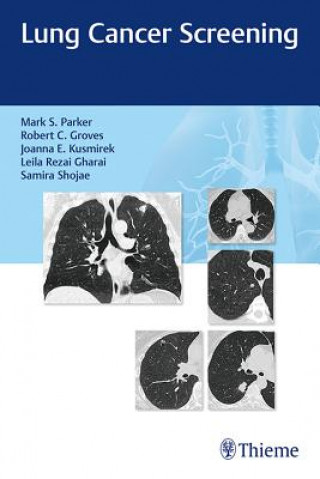 Könyv Lung Cancer Screening Robert C. Groves