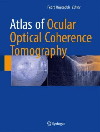 Könyv Atlas of Ocular Optical Coherence Tomography Fedra Hajizadeh