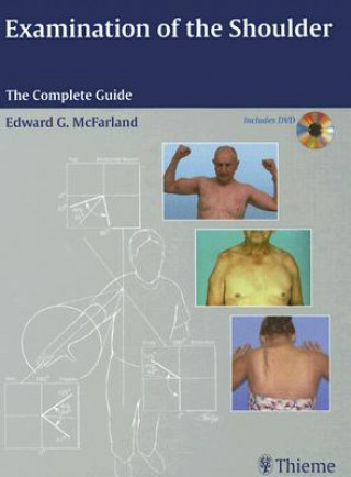 Buch Examination of the Shoulder Edward G. McFarland